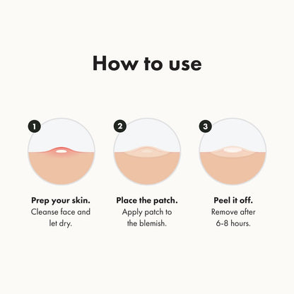 Mighty Patch Original from Hero Cosmetics - Hydrocolloid Acne Pimple Patch for Zits and Blemishes, Spot Treatment Stickers for Face and Skin, Vegan and Cruelty Free (36 Count)
